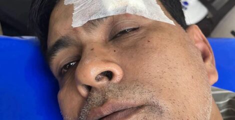 চকরিয়ায় যুবলীগ নেতার হামলায় গুরুতর আহত বিএনপি নেতা নয়ন চৌধুরী!